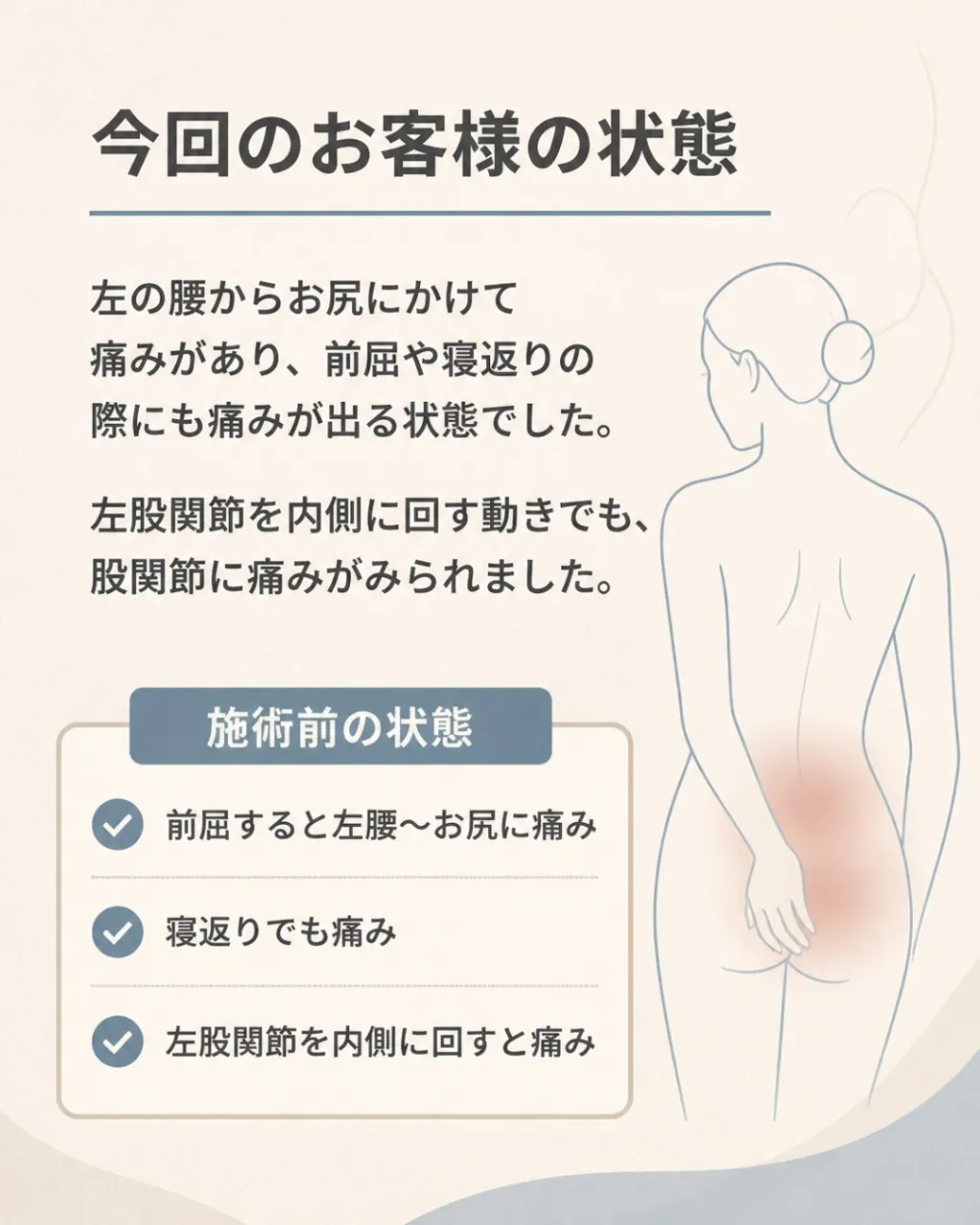 【左の腰からお尻にかけての痛み】