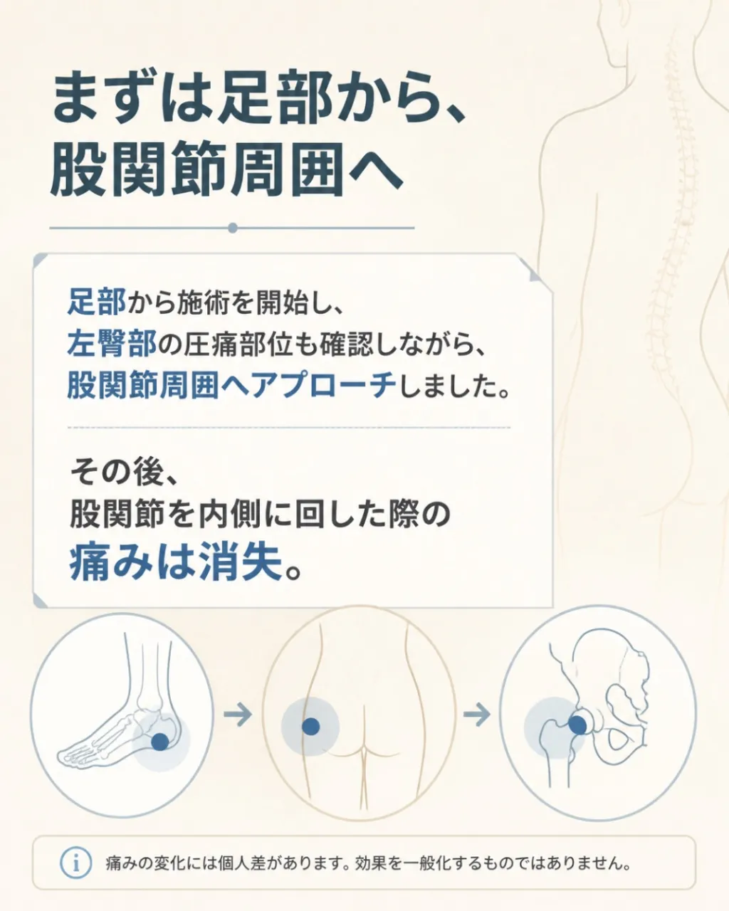 【左の腰からお尻にかけての痛み】